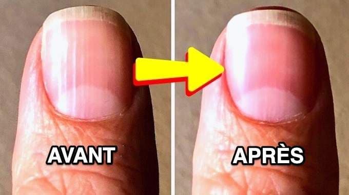 Produits de soin pour ongles