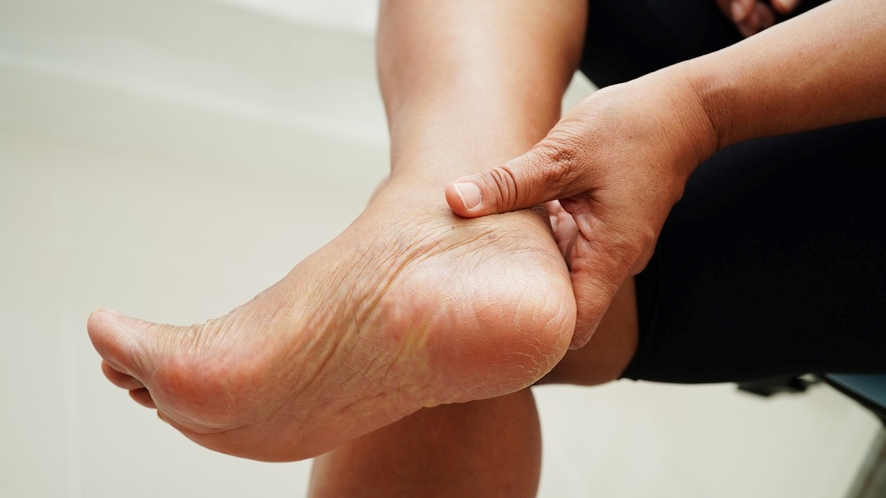 Pieds présentant des rougeurs anormales