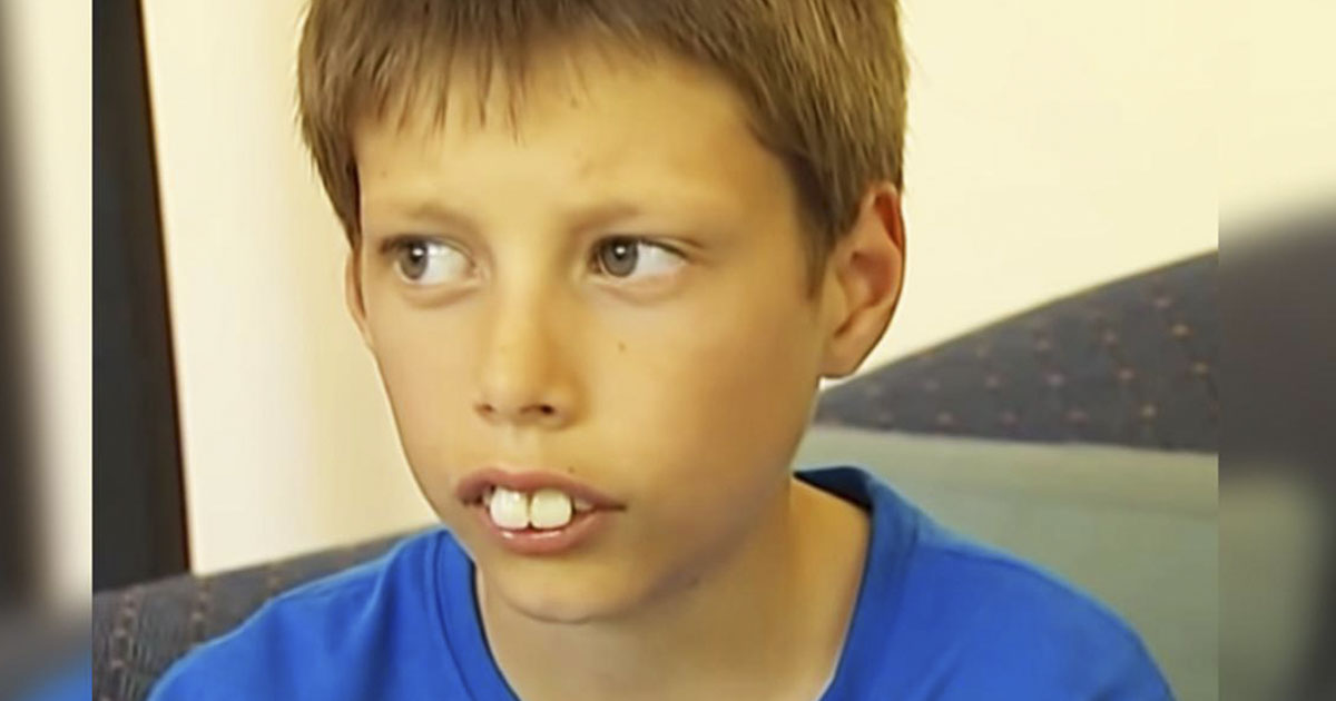 Evan Hill avant sa transformation orthodontique