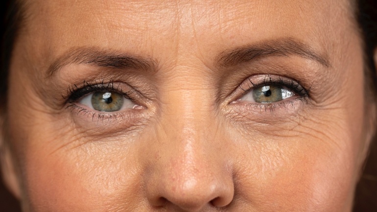 Ridules du visage et soin au bicarbonate
