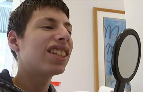 Evan Hill après son traitement, arborant un sourire éclatant