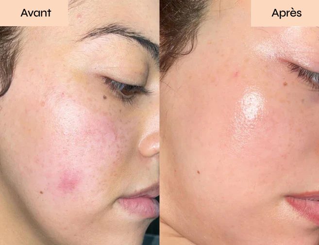 Application d'un soin visuel maison