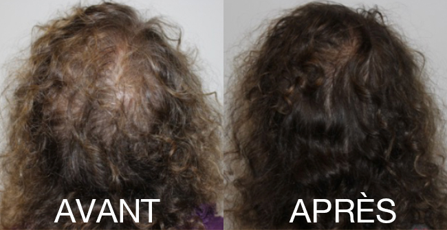 Comparaison visuelle de l'état des cheveux avant et après un soin
