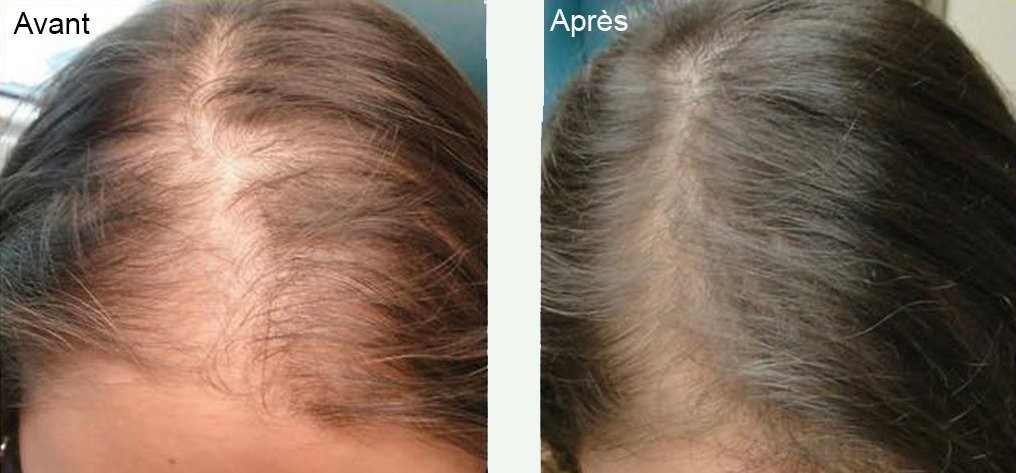 Comparaison avant-après de cheveux, montrant plus de brillance et de volume